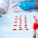 How Blood Type Affects Your Health