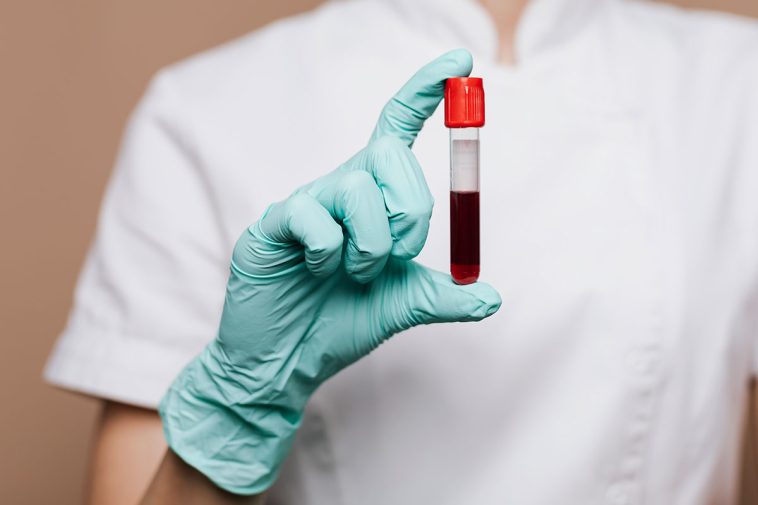 Your Blood Type Might Determine the Chances of Getting These Diseases